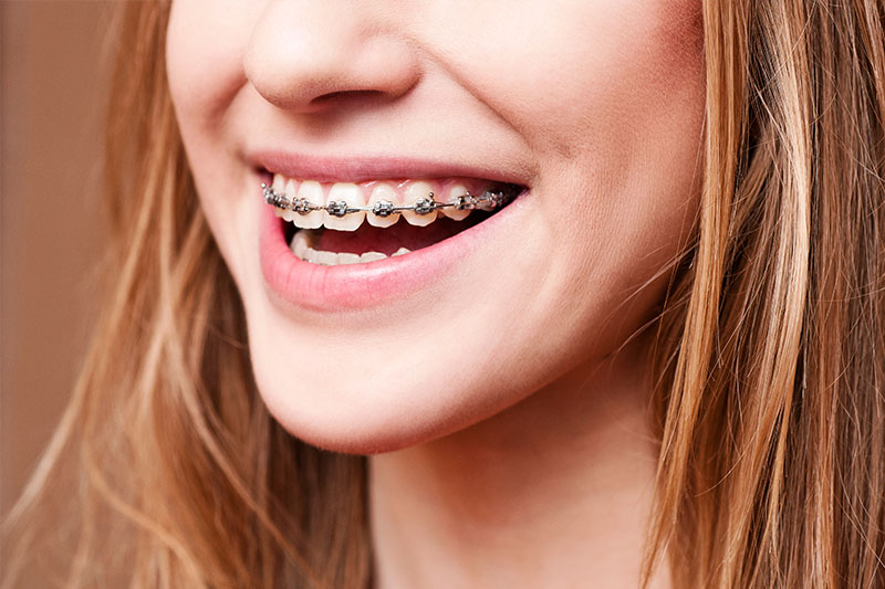 Orthodontics in Stamford